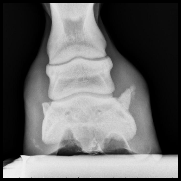 Radiograph of a hoof with sidebone because of deliberate long-term M-L imbalance